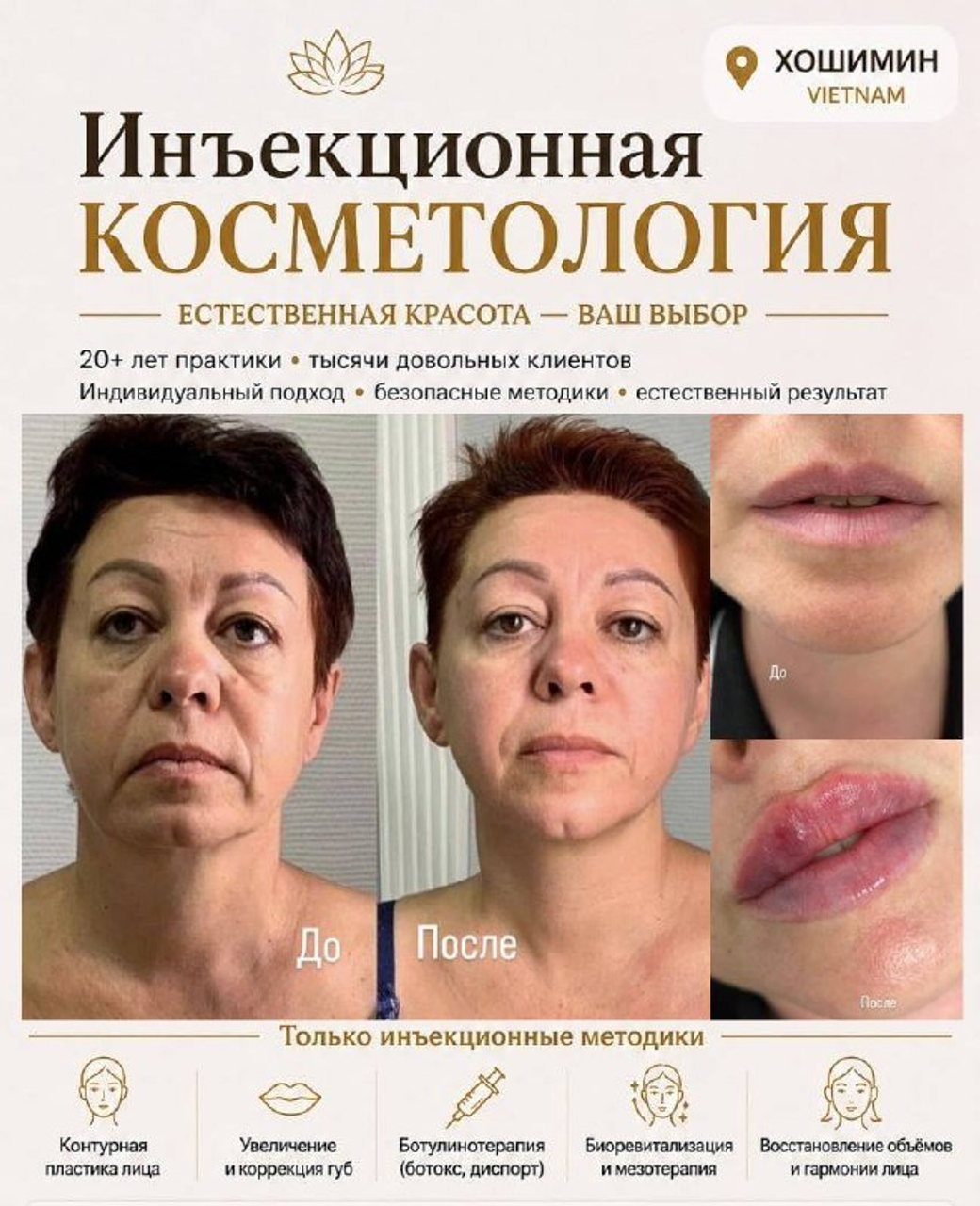 Инъекционная косметология