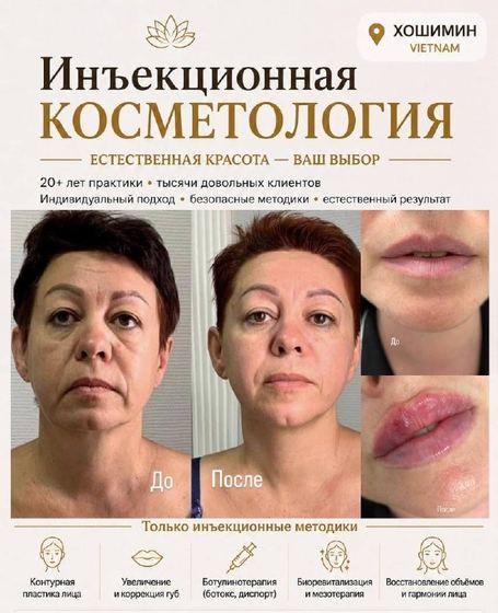 Инъекционная косметология